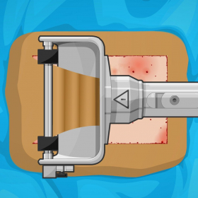 couverture jeu vidéo 2014 First Aid: Skin Surgery & Skin Doctor & Skin Hospital Office