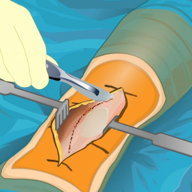 couverture jeu vidéo Knee Joint Surgery