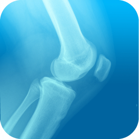 couverture jeu vidéo Knee Surgery Game