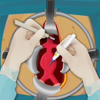 extrait jeux-video Aneurysm Surgery