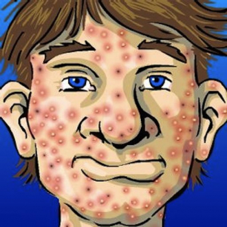 extrait jeux-video Atomic Zit Popper